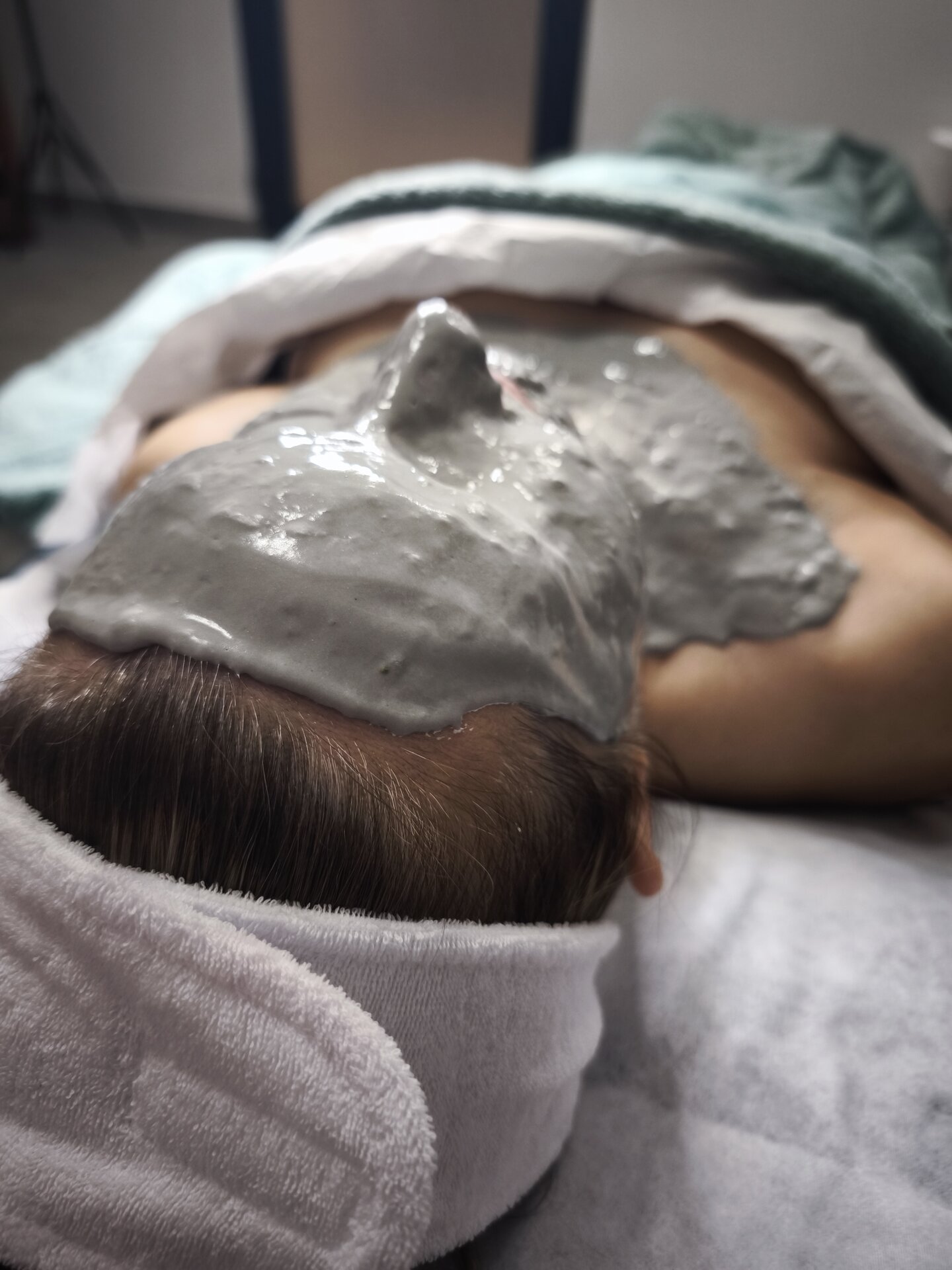 Home 4 mezoterapia próżniowa zabieg dermabalance